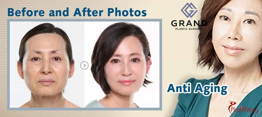 Anti-Aging Procedures in Seoul, South Korea